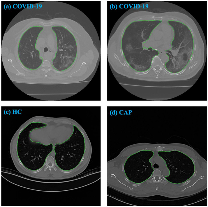 Fig. 7