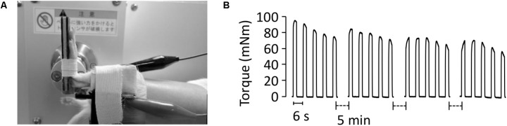 FIGURE 1