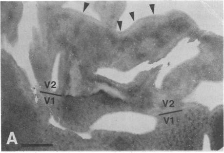 graphic file with name pnas00243-0328-a.jpg