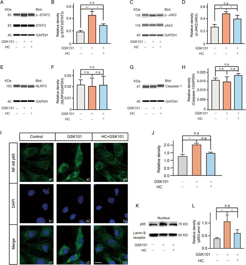 TRPV4-induced Müller Cell Gliosis And TNF-α Elevation-mediated Retinal ...