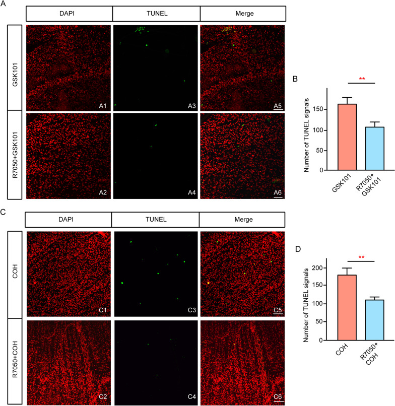 TRPV4-induced Müller Cell Gliosis And TNF-α Elevation-mediated Retinal ...