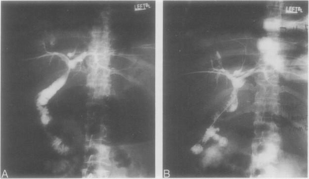 Fig. 7A and B.