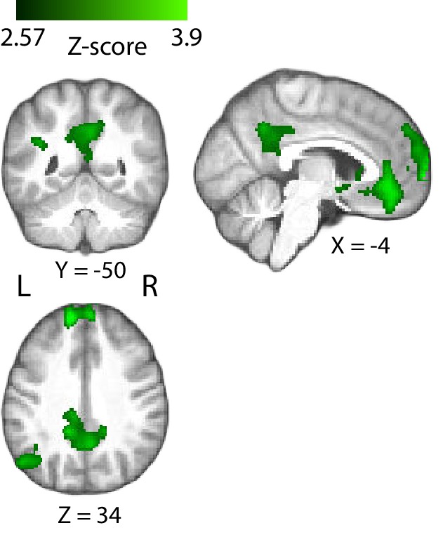 Figure 5—figure supplement 1.