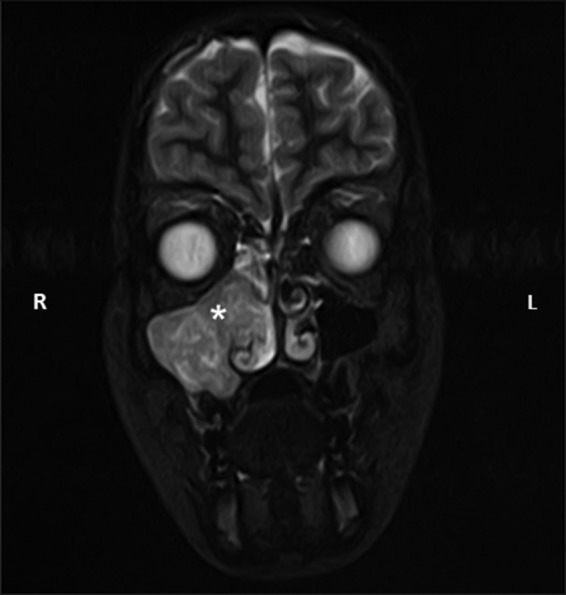 Figure 2: