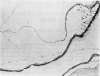 95
