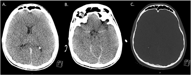 Fig. 1