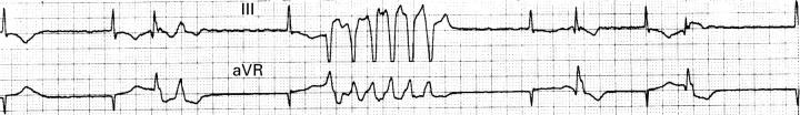 Figure 2  