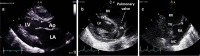 Fig. 14