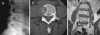 Fig. 1