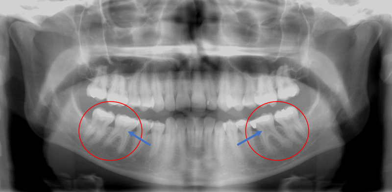 Figure 2: