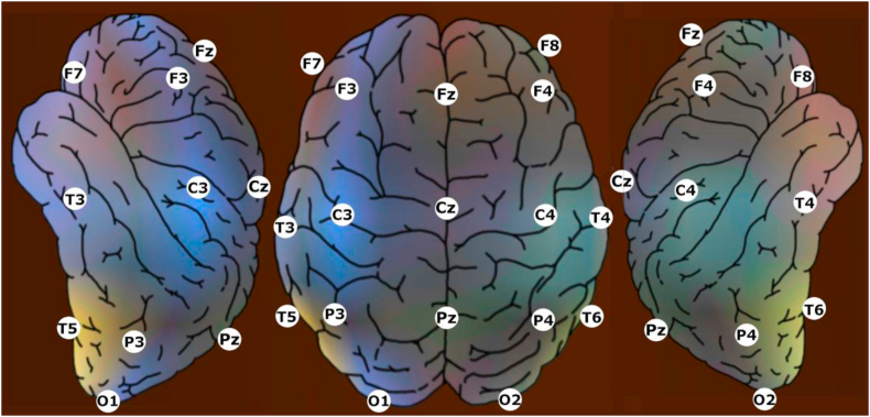 Figure 2