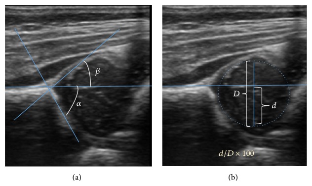 Figure 11