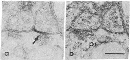 graphic file with name pnas00030-0173-a.jpg