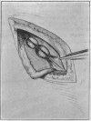 402