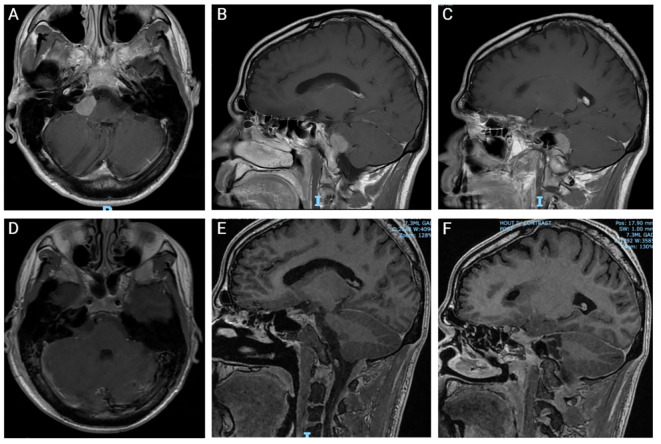 Figure 1