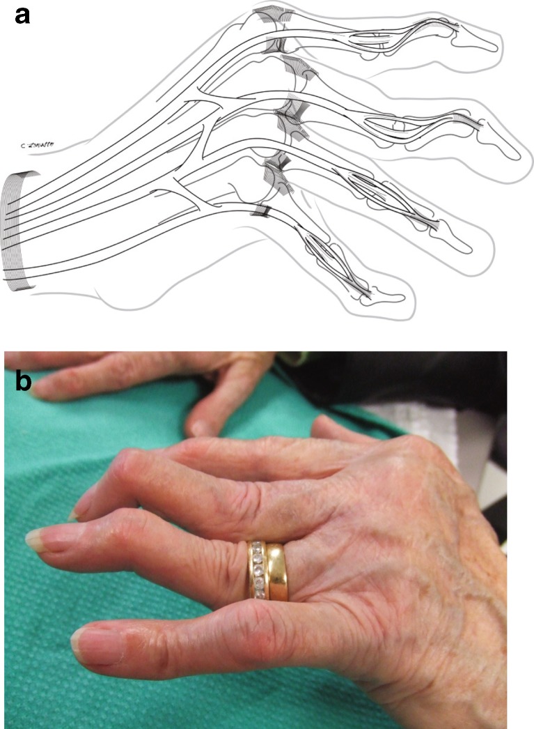 Fig. 6