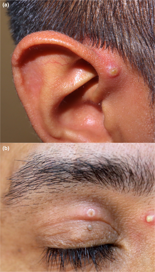 FIGURE 3