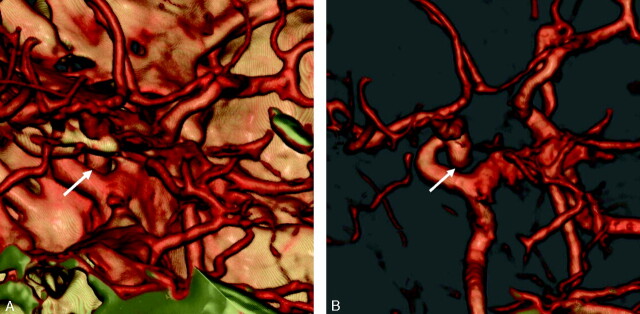 Fig 5.