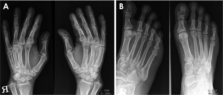 Fig. 4