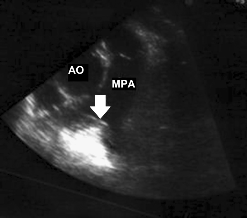 Fig. 1