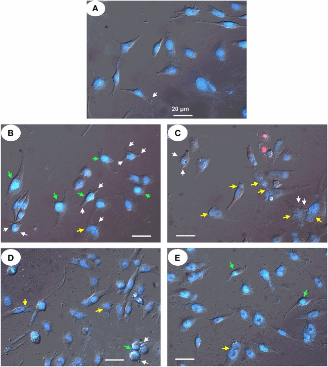 Figure 11