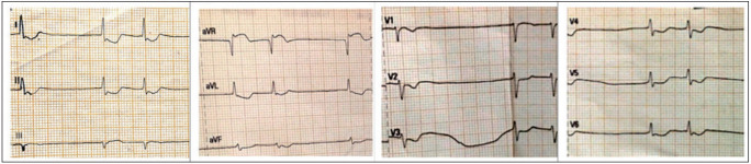 Fig. 2.