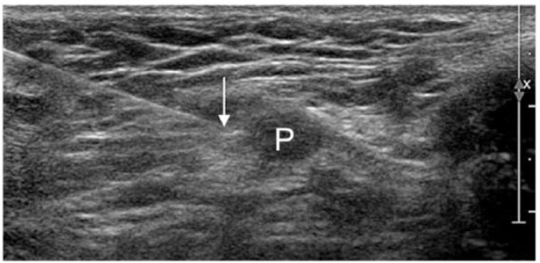 Figure 15.