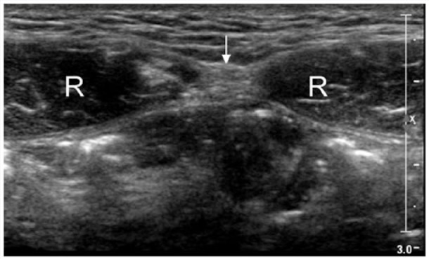 Figure 9.