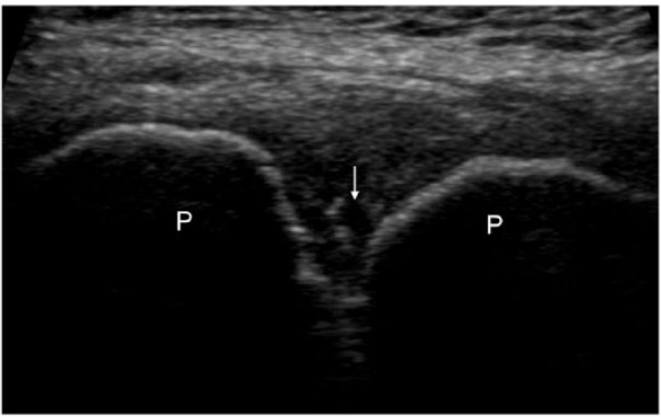 Figure 13.
