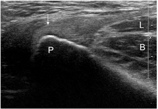 Figure 11.