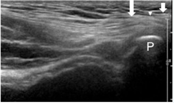Figure 10.