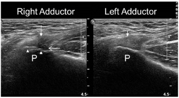 Figure 12.