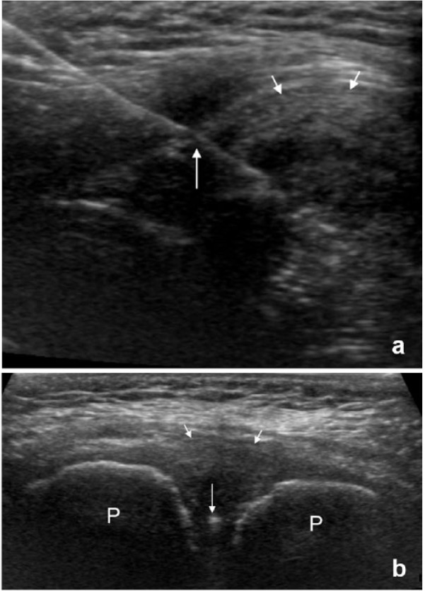 Figure 14.