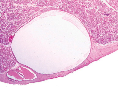 Fig. 12-169