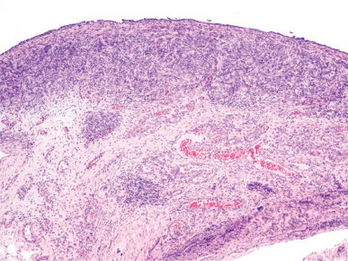 Fig. 12-62