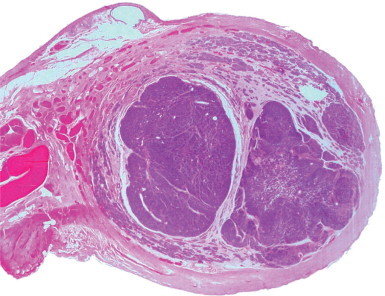 Fig. 12-75