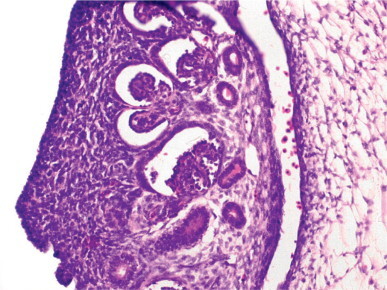 Fig. 12-3