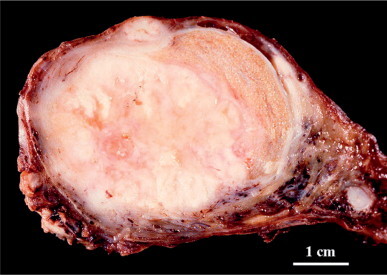 Fig. 12-158