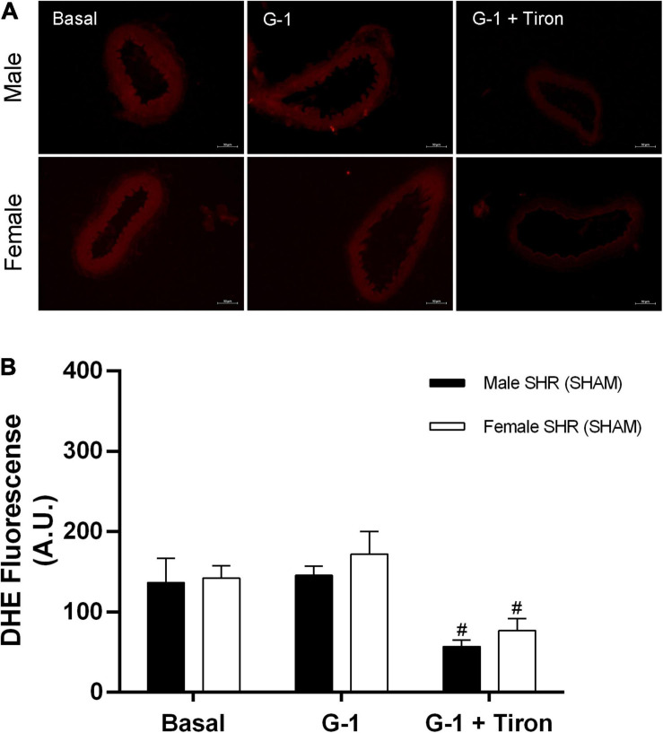 FIGURE 11