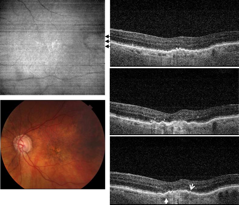 Fig. 4