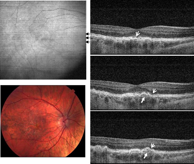 Fig. 2