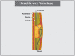 [Table/Fig-11]: