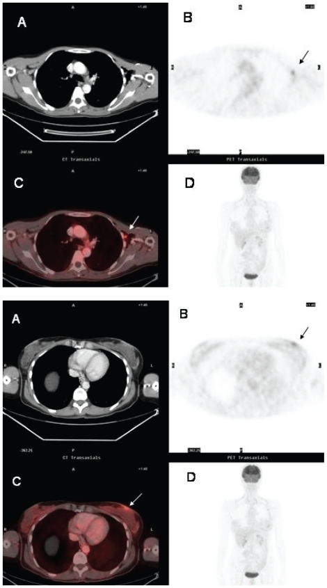 Figure 2A y 2B