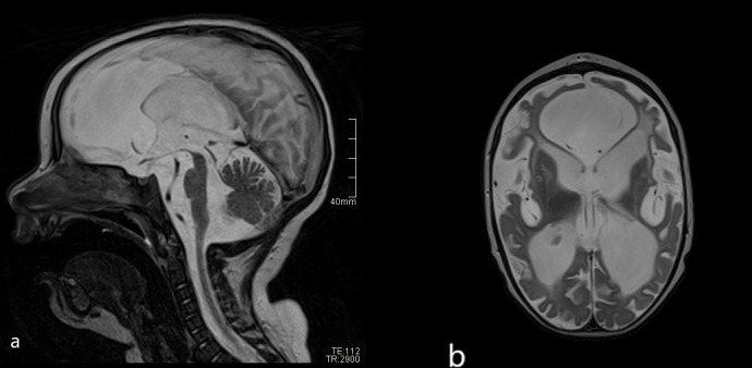 Figure 3