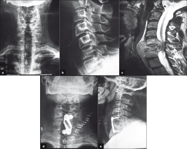 Figure 1a-b