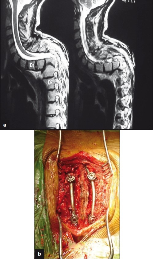 Figure 4a-b