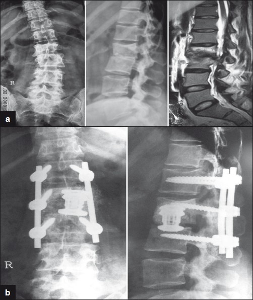 Figure 3a-b