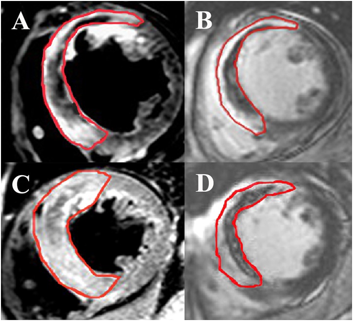 Fig 2