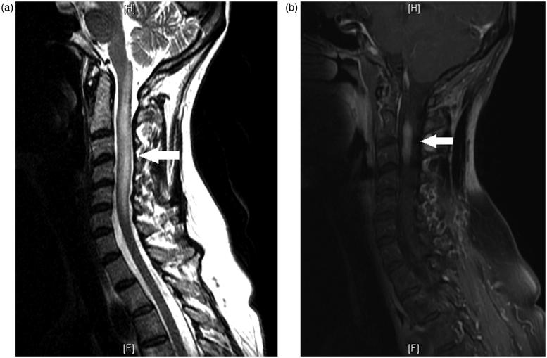 FIGURE 2