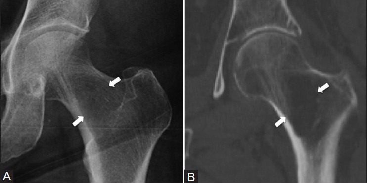 Figure 3 (A and B)